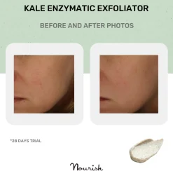 Kale Enzymatic Exfoliator, 50 ml